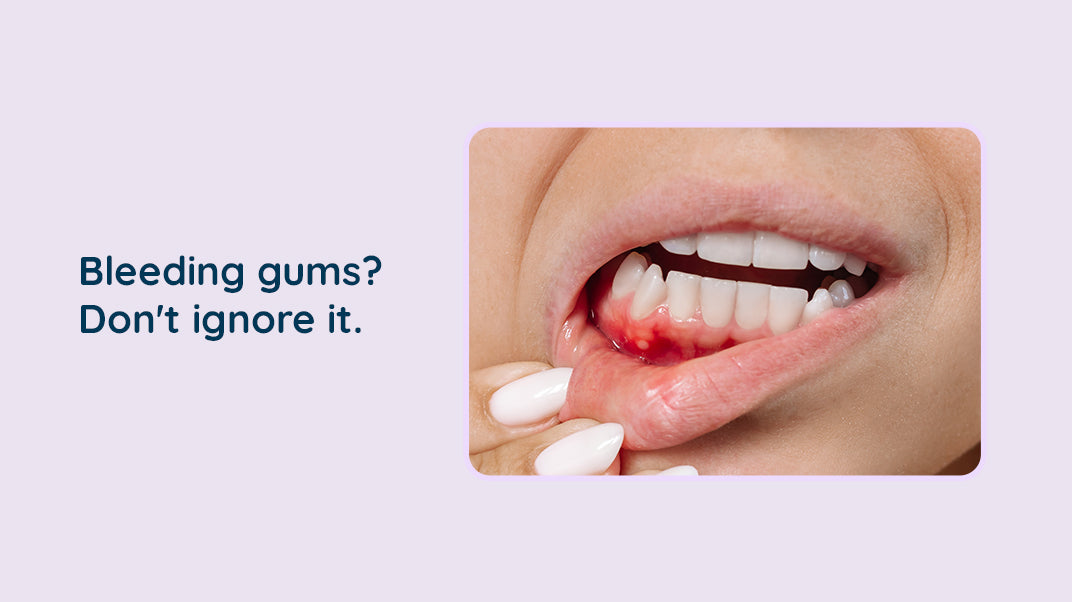 5 Causes of Bleeding Gums You Should Know, electric toothbrush, cordless water flosser