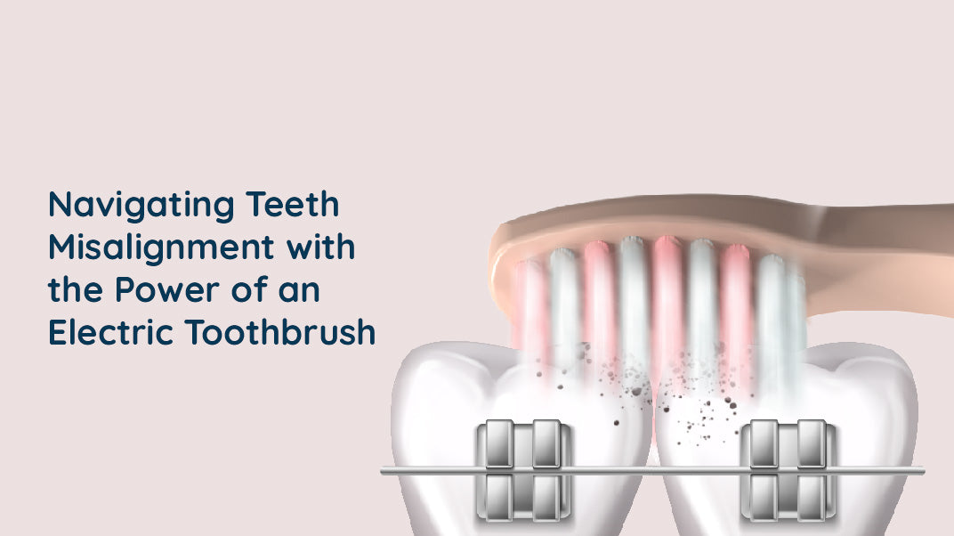 Orthodontic Options When You Have Teeth Misalignment