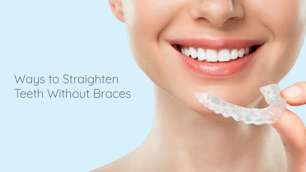 How to Straighten Teeth Without Braces ?