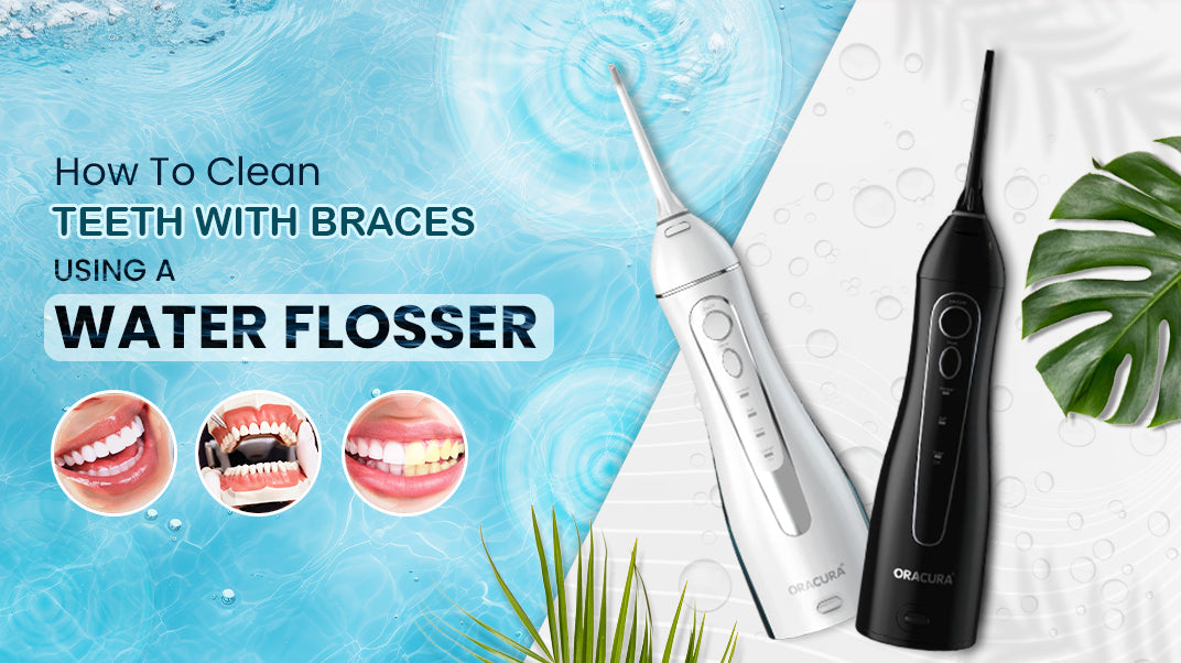 How To Clean Teeth with Braces Using A Water Flosser