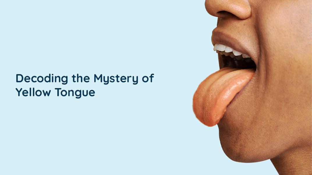 Yellow Tongue: Symptoms, Causes, And Treatments