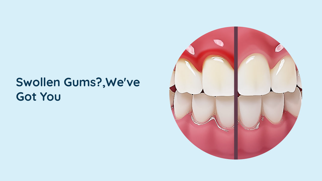 What Causes A Swollen Gum Around Tooth?