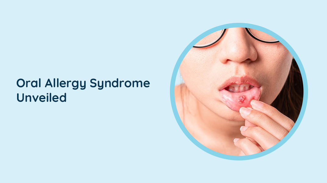 What is Oral Allergy Syndrome?