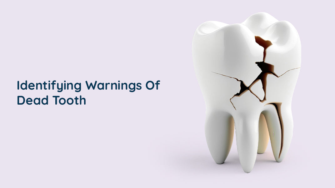 Fdead Tooth What are The Signs of a Dead Tooth? – ORACURA