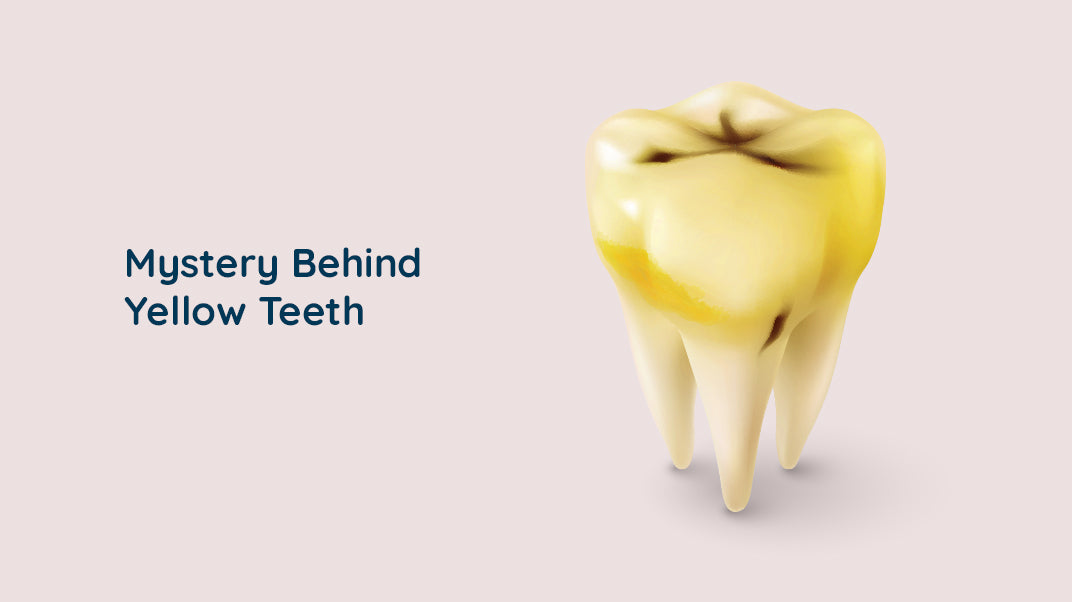 10 Causes of Yellow Teeth and Solutions for Them