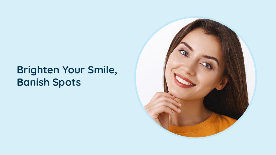 Causes Of Brown Spots On Teeth