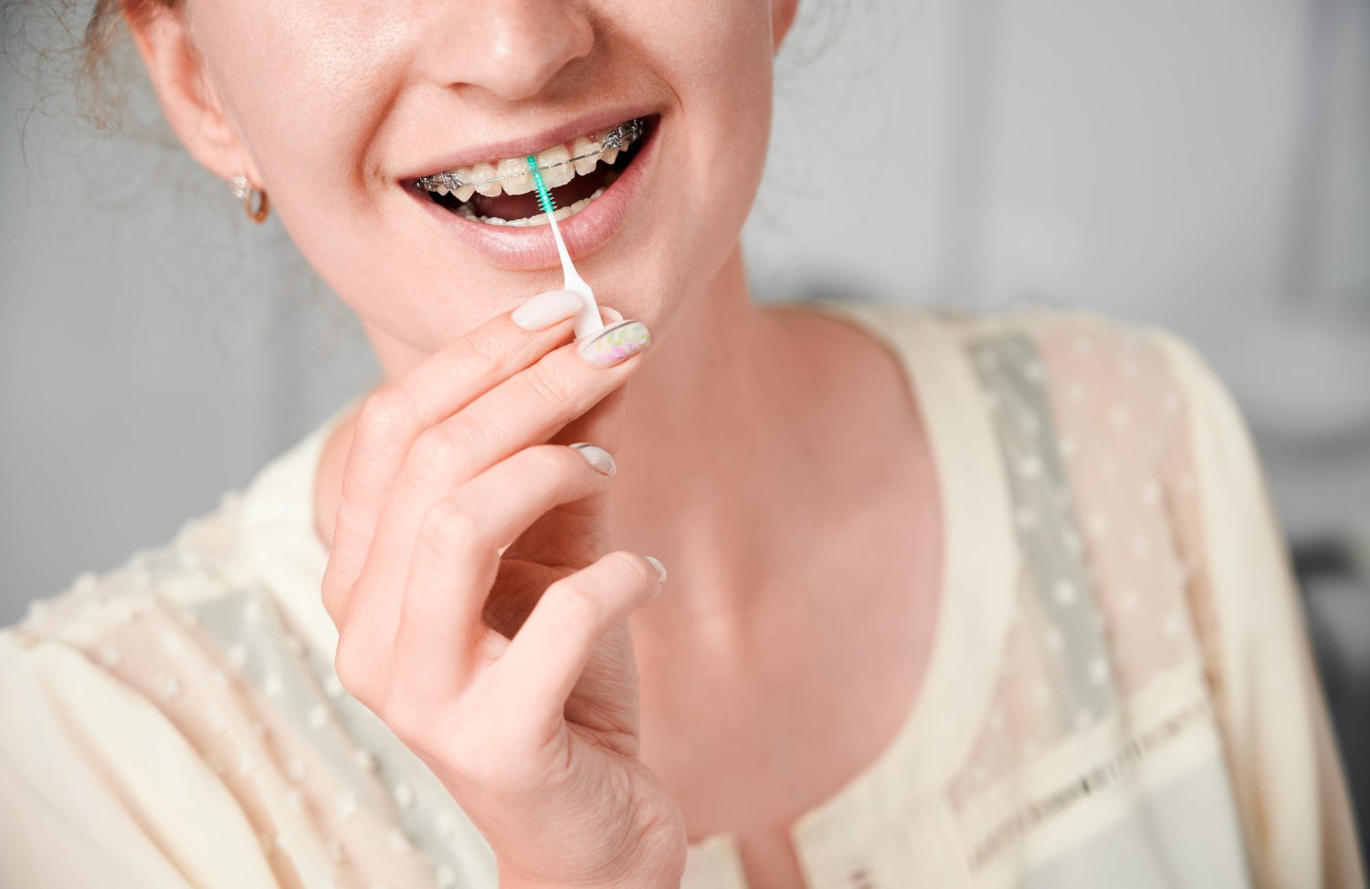 Oral Hygiene Tips for Adults with Braces or Crowded Teeth