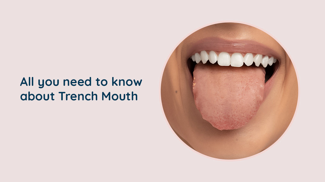 What is Trench Mouth ?, gingivitis, electric toothbrush