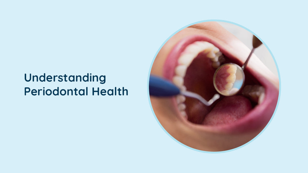 What are periodontal pockets ?