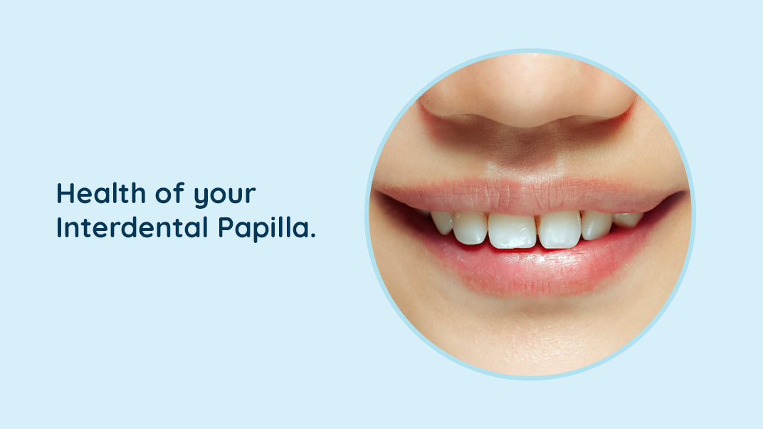 Identifying Healthy Interdental Papilla: Four Key Signs