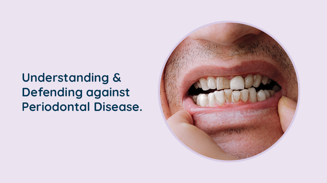 Periodontal Disease: Causes & Prevention