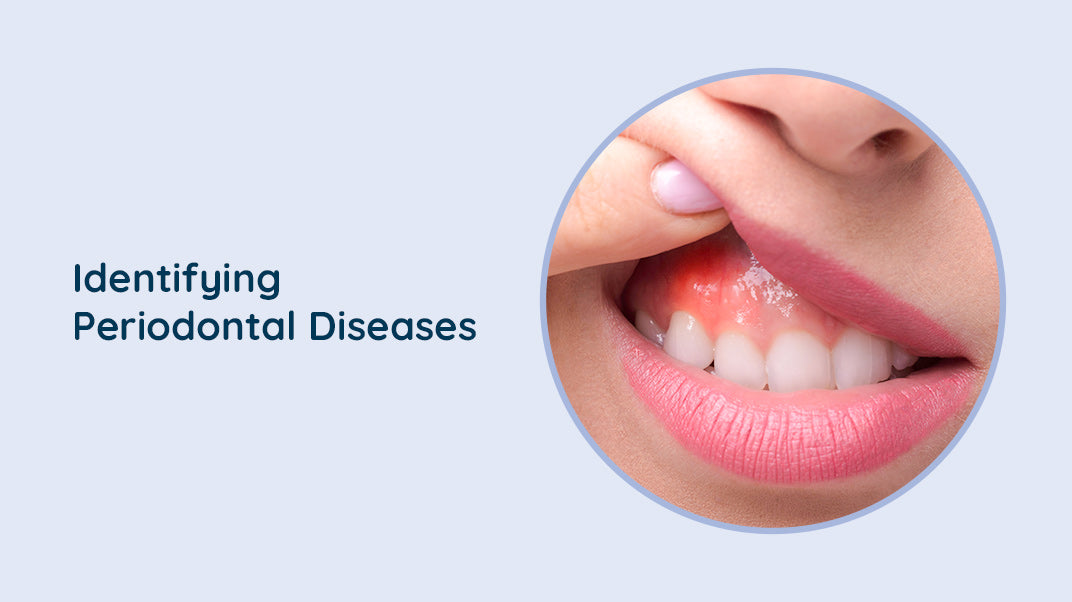 What are the symptoms of Gum Diseases ?