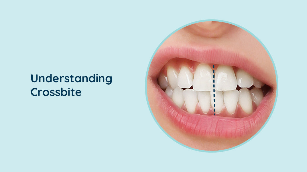 What is a Crossbite? What are the Signs and Treatments?, electric toothbrush, water jet flosser