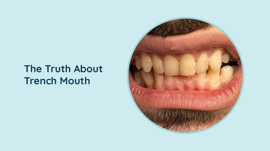 How dangerous is Trench Mouth ?, electric toothbrush, dental water jet