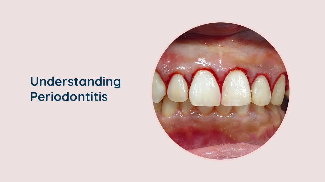 Causes of Periodontal Disease, best electric toothbrush, best water flosser