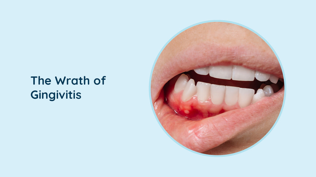 Signs and Impact of Gingivitis on your Oral Health
