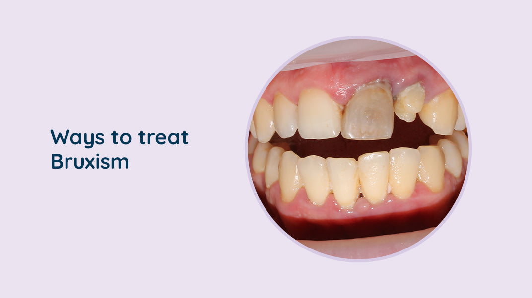 What are some treatments to cure Bruxism ?