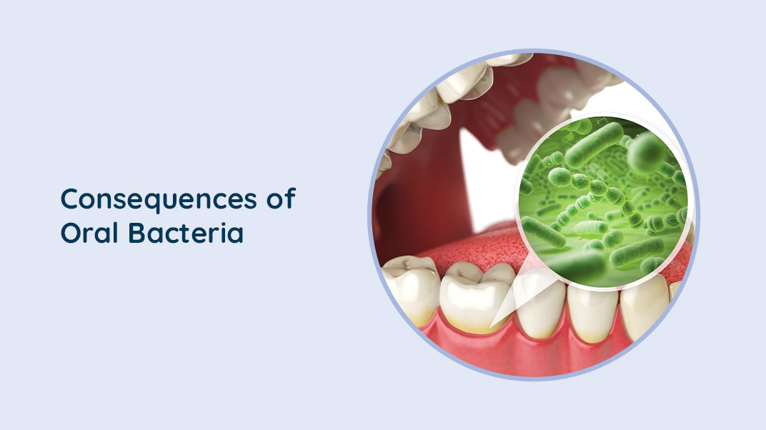 From Plaque to Peril: How Oral Bacteria Impact Dental Health