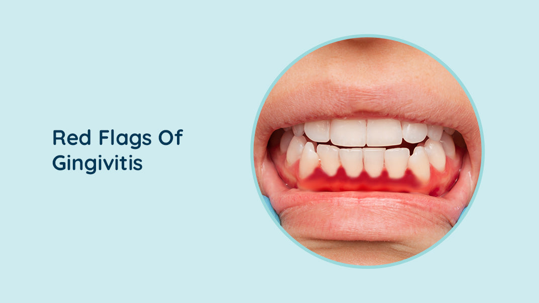 Don't Ignore Your Gums: Warning Signs of Gingivitis You Shouldn’t Overlook, automatic toothbrush, best water flosser, oracura