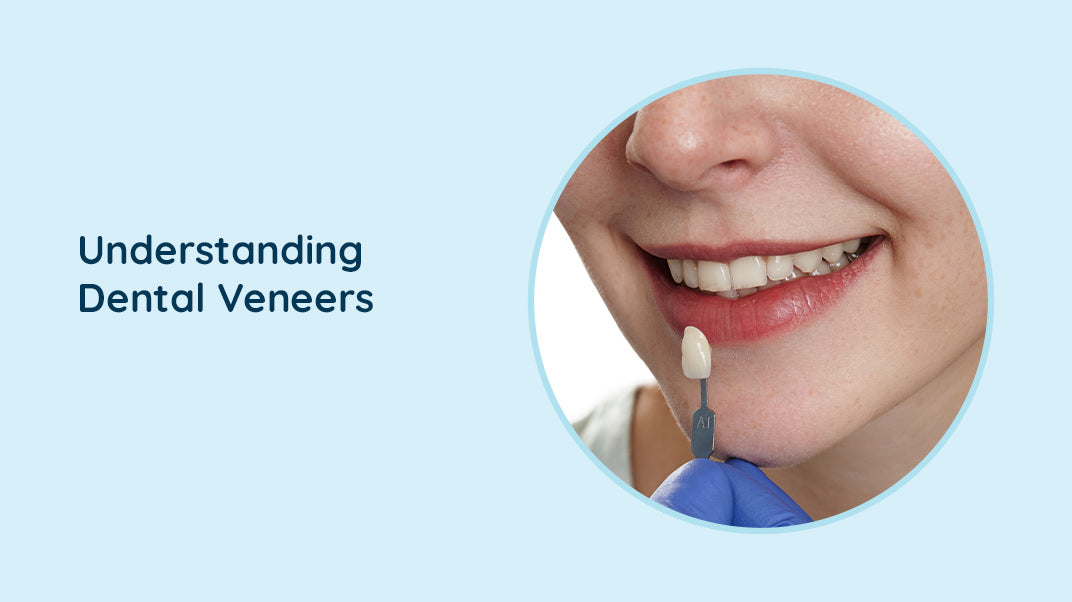 The Pro’s and Con’s of Dental Veneers