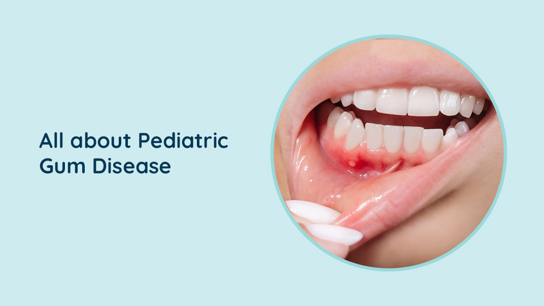 Understanding Gum Disease in Kids:  What Parents Need to Know