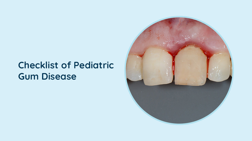 Essential Insights Into Pediatric Gum Disease: What Every Parent Should Understand, best electric toothbrush, water flosser for teeth,  ORACURA®