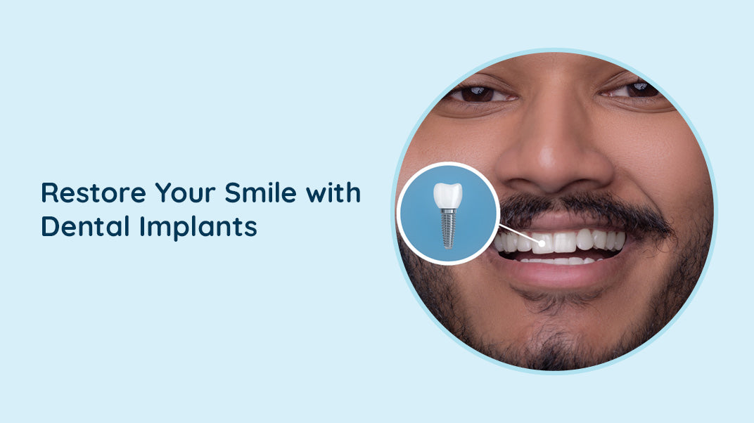 Why Single Tooth Dental Implants Are Necessary?