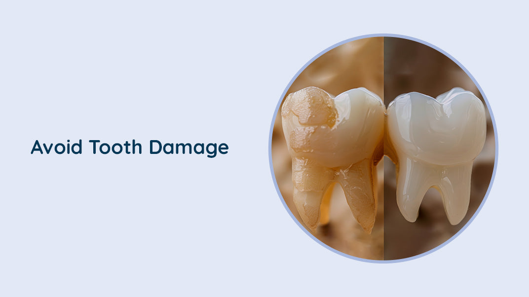 Protecting Your Smile: Tips for Preventing Cracked and Broken Teeth