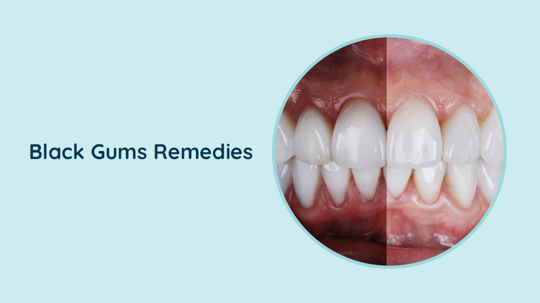 Effective Treatment Methods for Black Gums