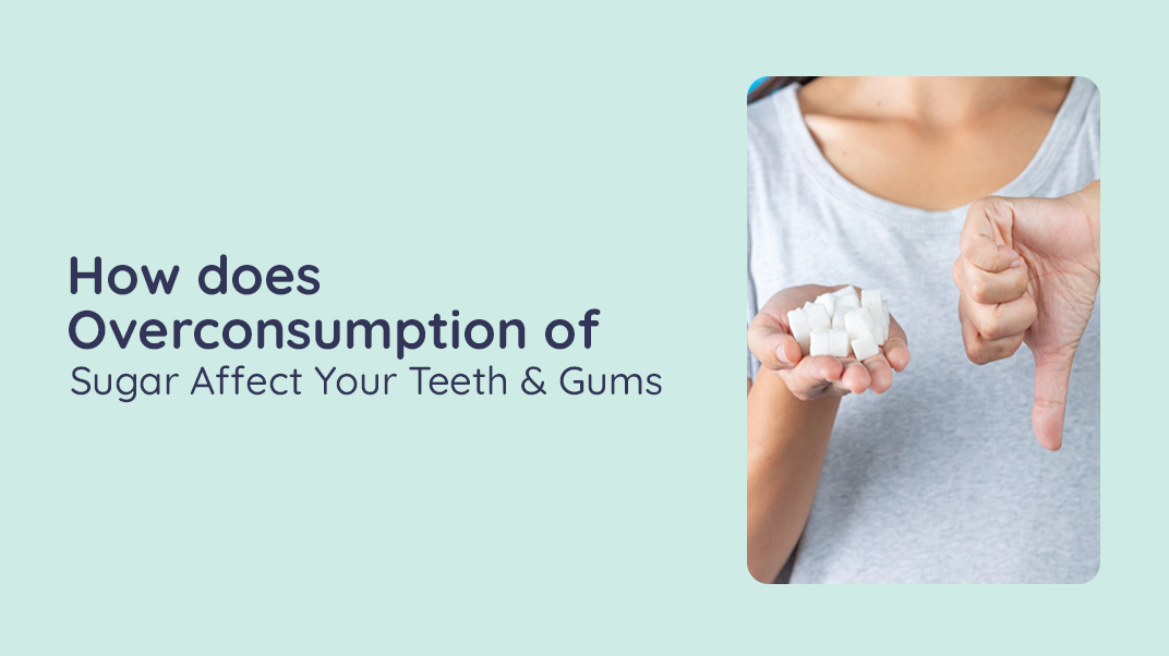 How does Overconsumption of Sugar Affect Your Teeth & Gums?