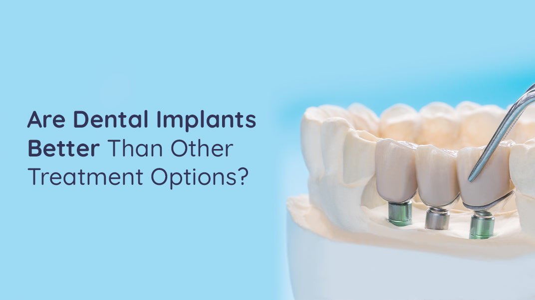 What Are The Benefits of Dental Implants?