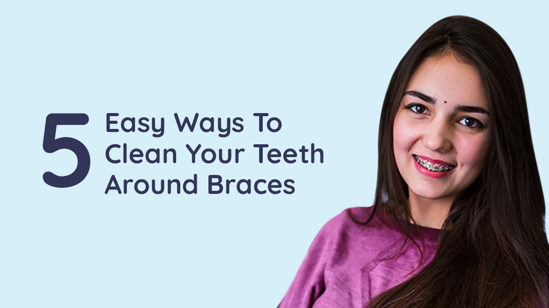 5 Tips for Easy & Effective Cleaning Around Braces