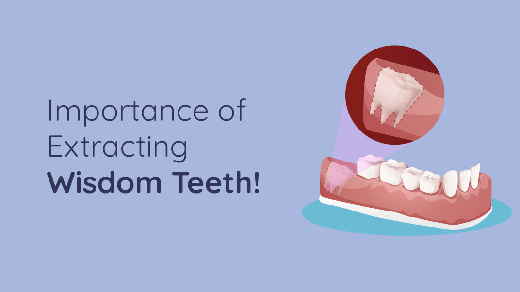 Why is Wisdom Teeth Removal Important?