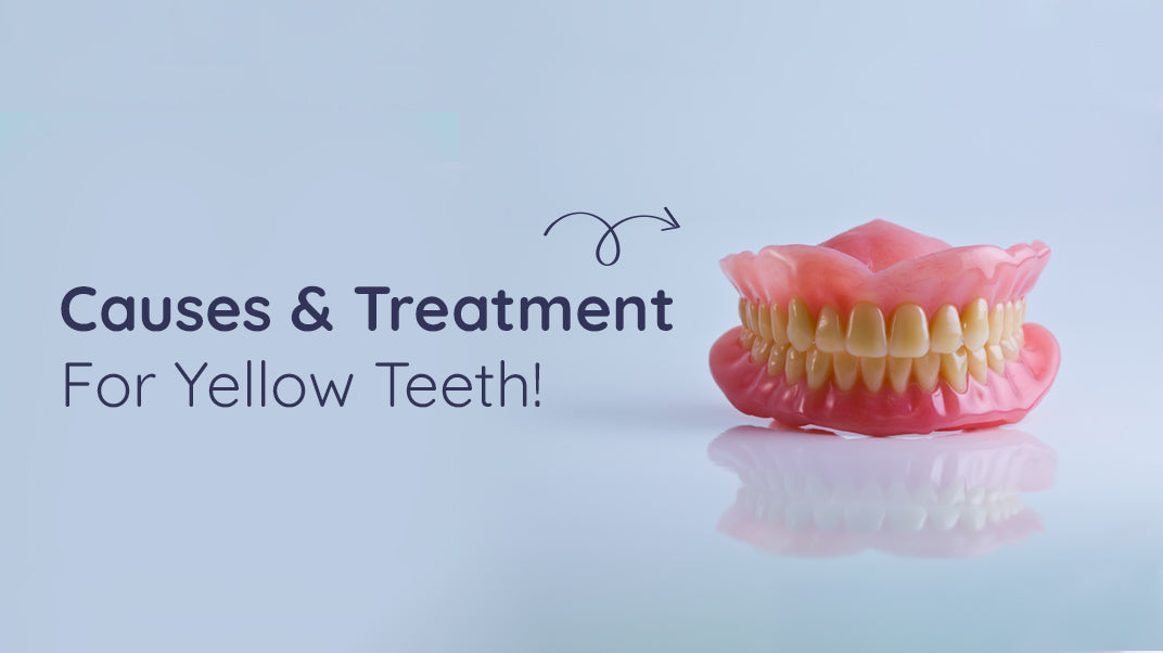 What Are The Ways To Whiten Yellow Teeth?