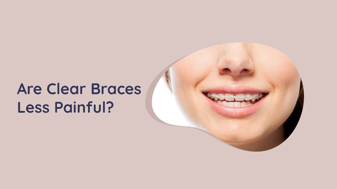 Do Clear Braces Hurt Less Than Metal Ones?