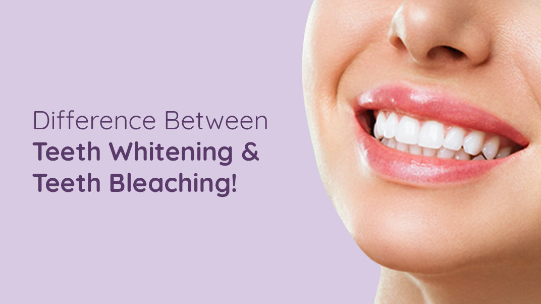 Teeth Whitening vs Teeth Bleaching, What's Better?