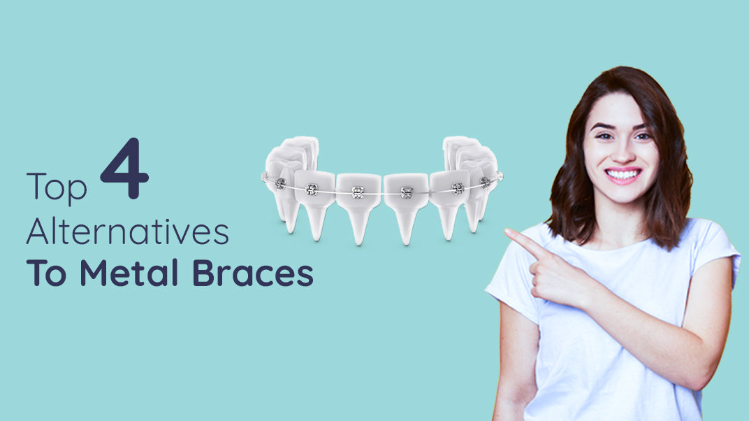 What Are The Other Alternatives To Metal Braces?