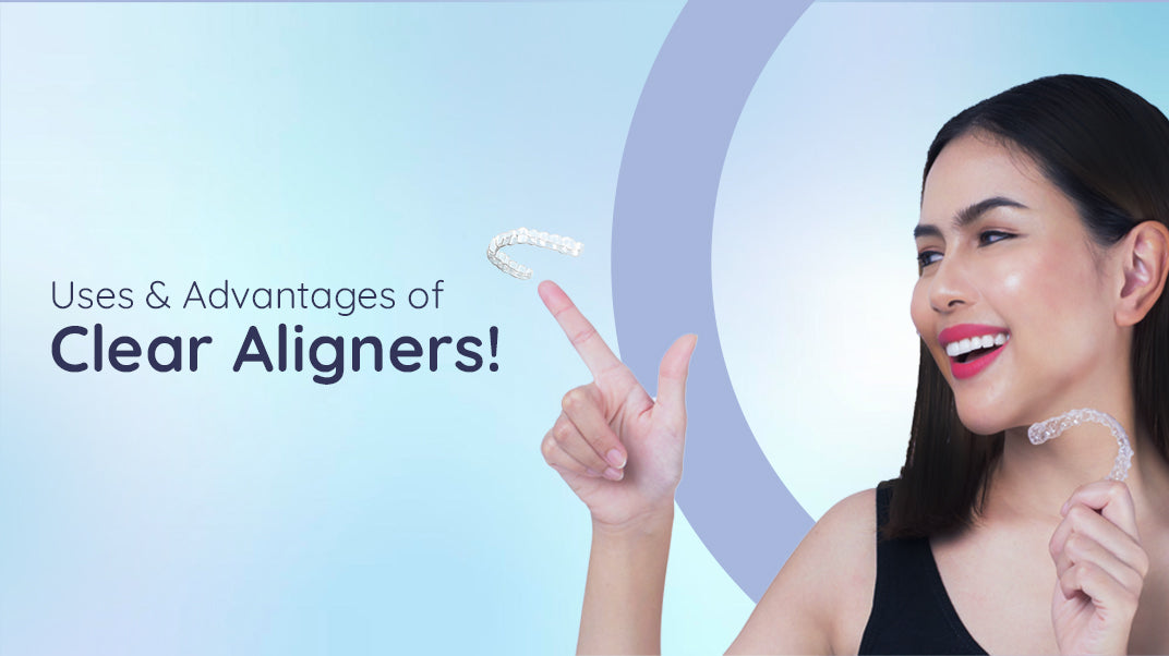 What Are Clear Aligners? Uses and Benefits!