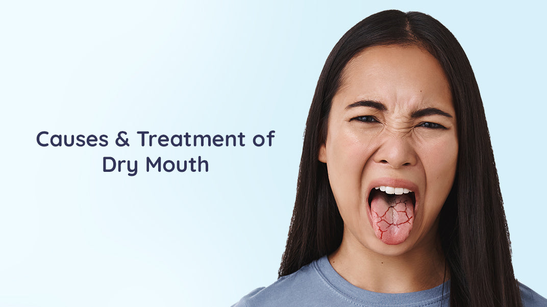 What Causes Dry Mouth & How To Treat It?