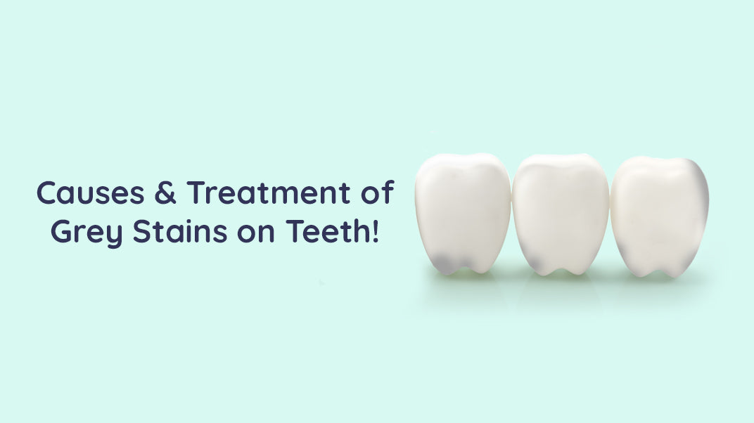 Grey Tooth Discoloration