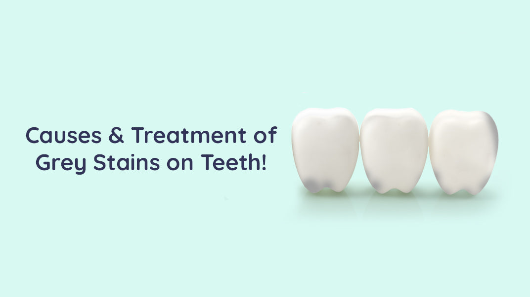 What Causes & How To Treat Grey Stains on Teeth?