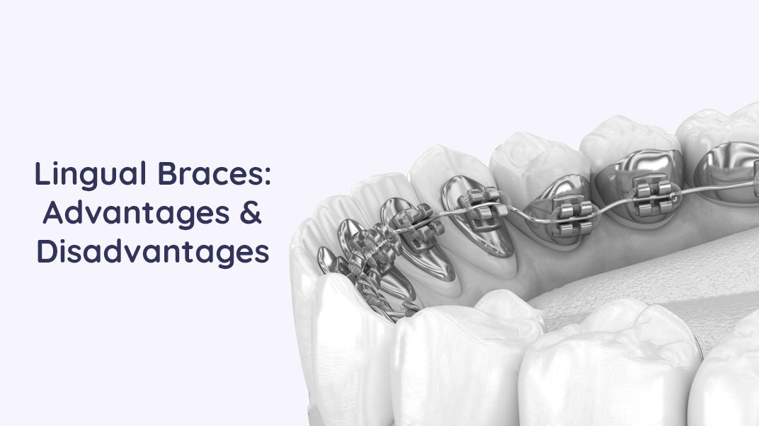 What Are The Pros And Cons of Lingual Braces?