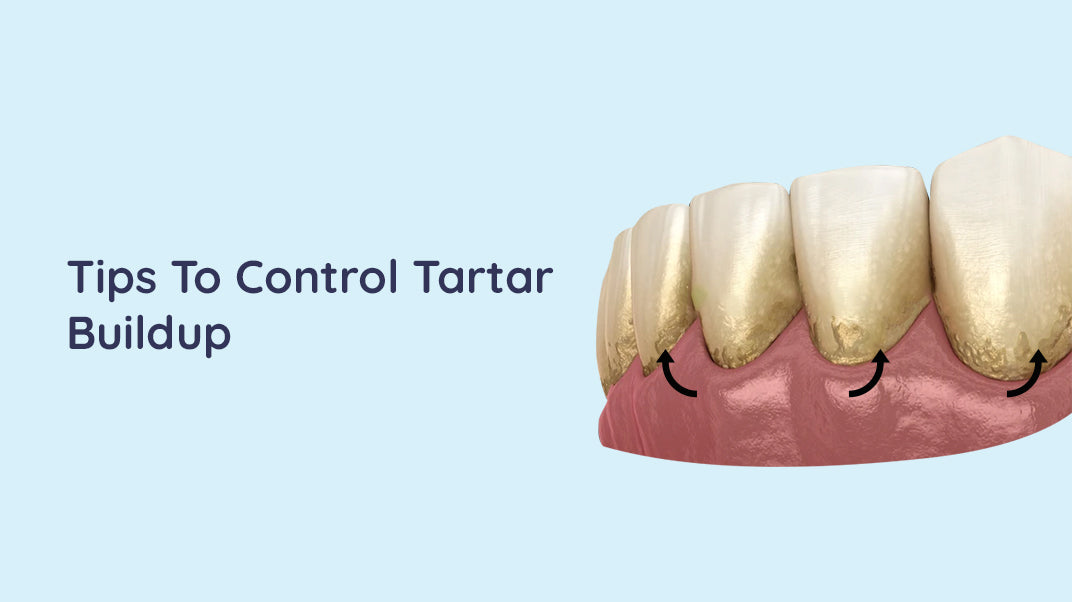 Here Are 5 Amazing Tips To Control Tartar Buildup!