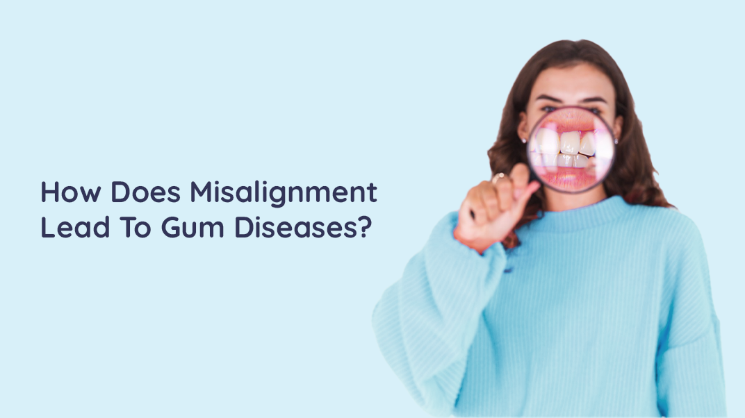 Did You Know Misalignment Could Lead To Gum Diseases?