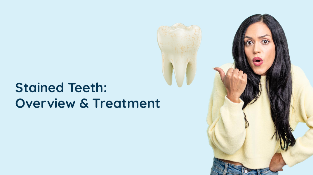 What are Stained Teeth and How to Remove Them