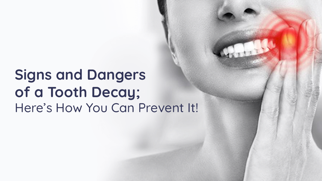 Signs & Dangers of a Tooth Decay; Here's How You Can Prevent It!