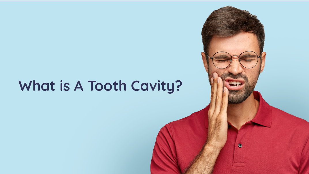 What Is a Tooth Cavity