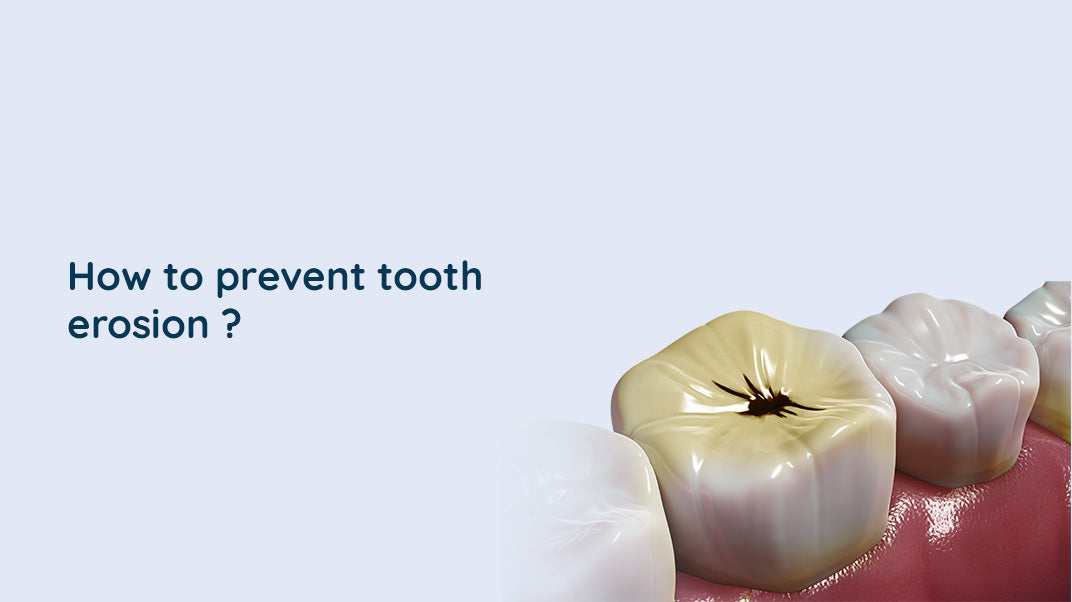 What is Tooth Erosion? Causes, Diagnosis, and Treatment
