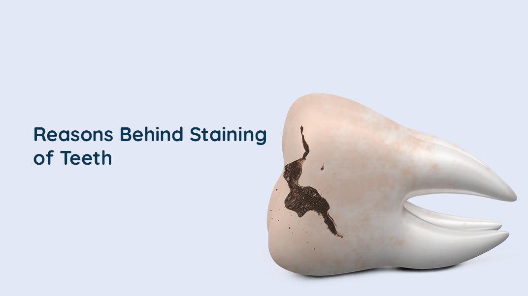 How Do Teeth Become Stained?