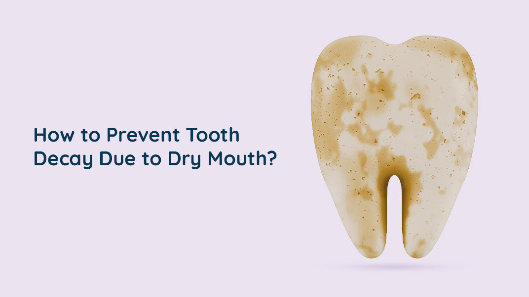 Preventing Tooth Decay Due To Dry Mouth